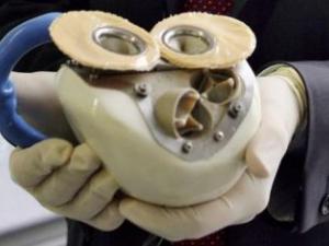 Cirujanos franceses implantan con éxito segundo corazón artificial